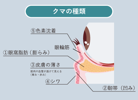 ①眼窩脂肪