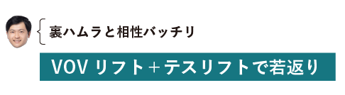 中顔面のリフトアップに