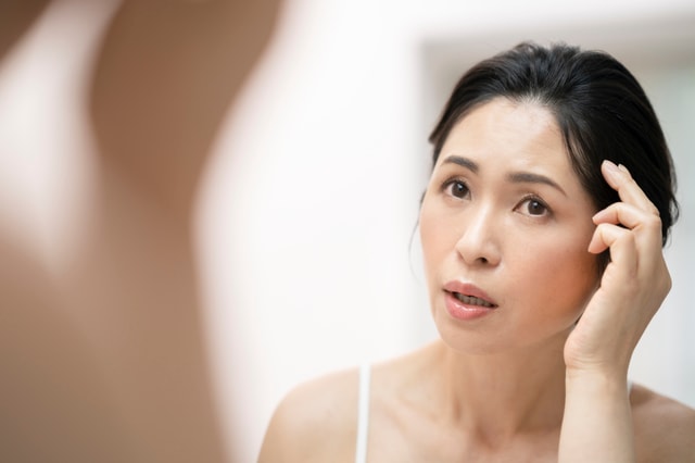 女性の生え際が後退する原因は？おでこの薄毛対策を紹介