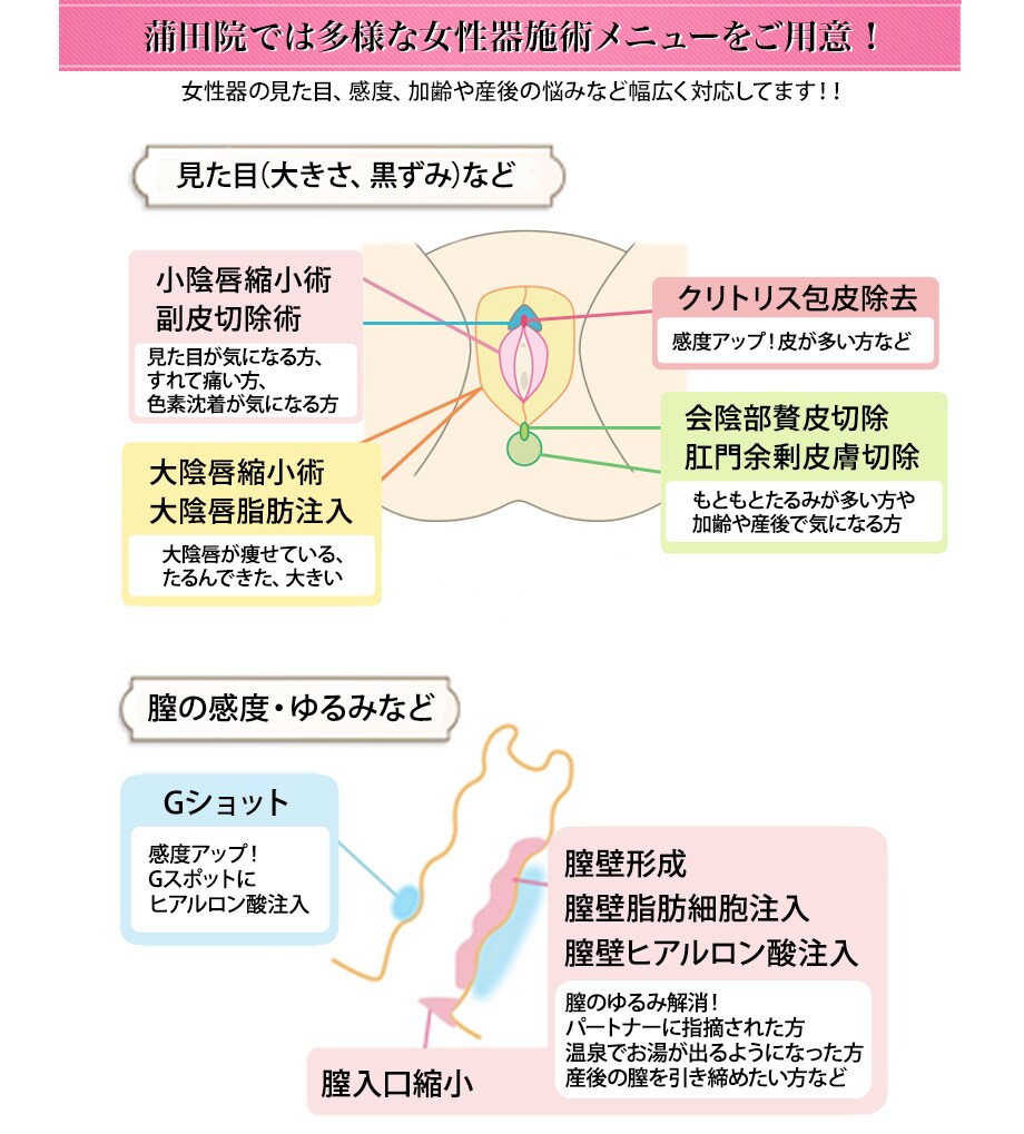 女性器の見た目 感度 膣のお悩み 性交痛 婦人科形成モニター募集 美容整形 美容外科の湘南美容クリニック