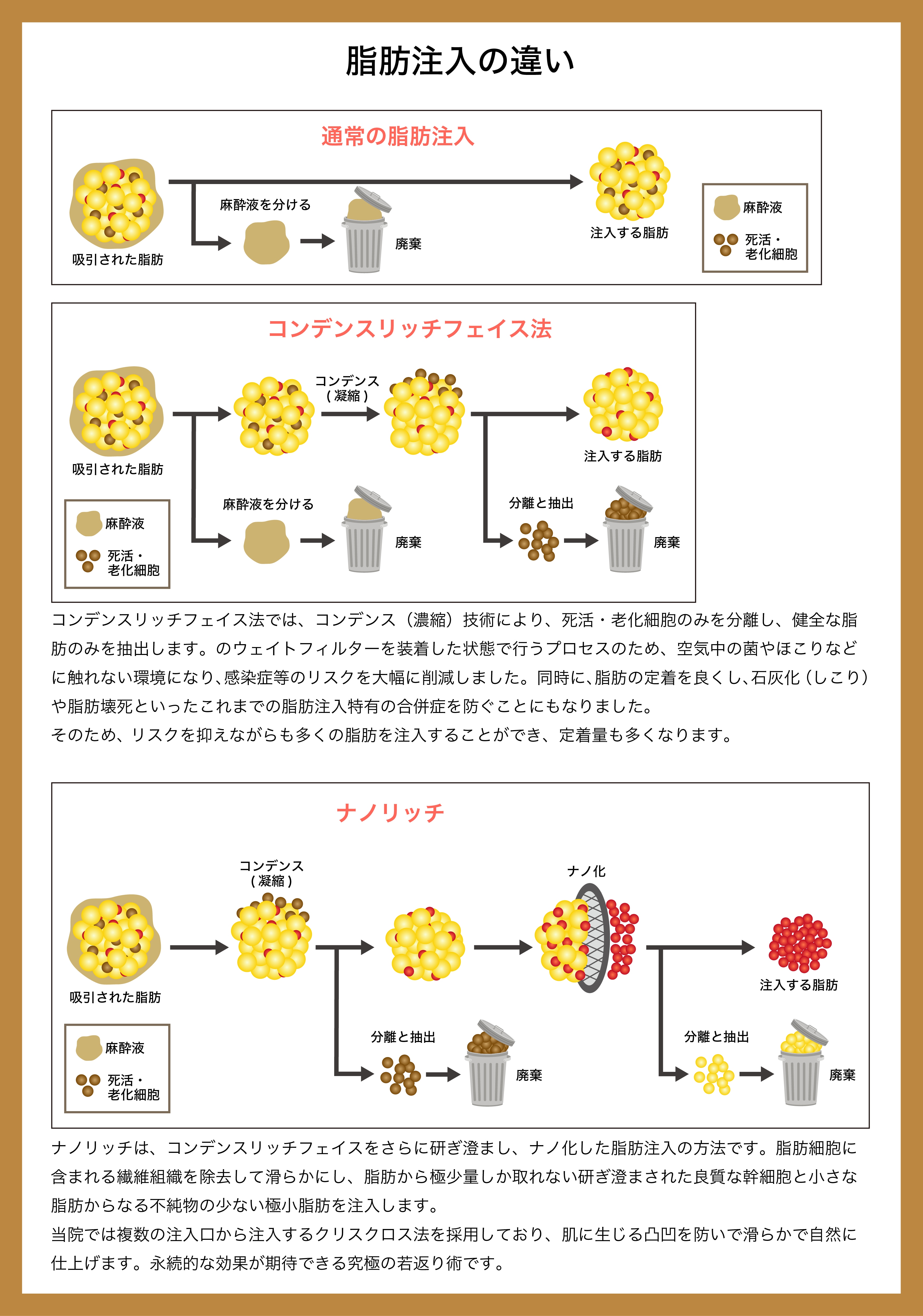 施術解説